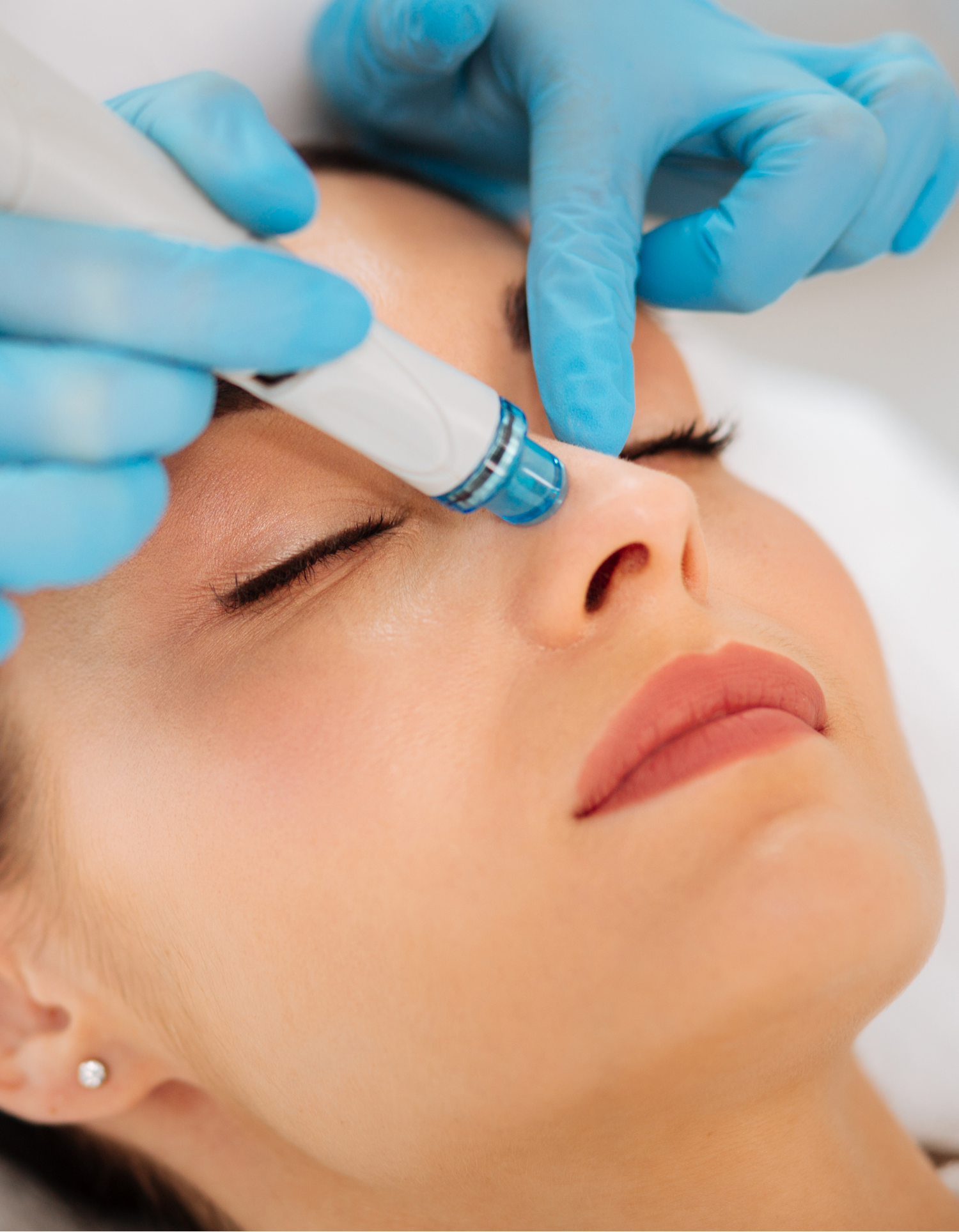 Hydrafacial Behandlung Gesicht