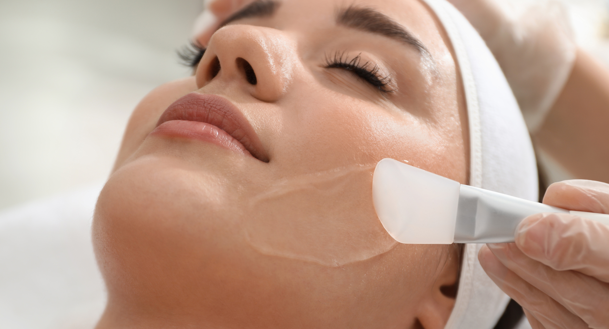 Chemisches Peeling bei Gesichtsbehandlung | CP-Praxis Basel und Bottmingen