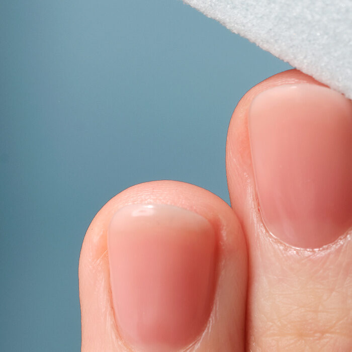 Close-up of nails before manicure treatment at CP Praxis Basel and Bottmingen