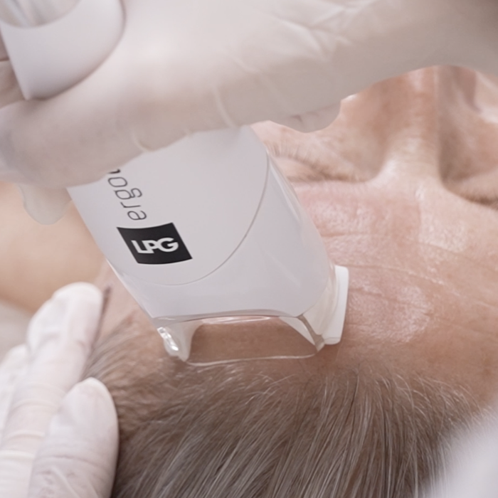 CP Praxis client Daniela from Basel after her LPG Endermologie treatment series