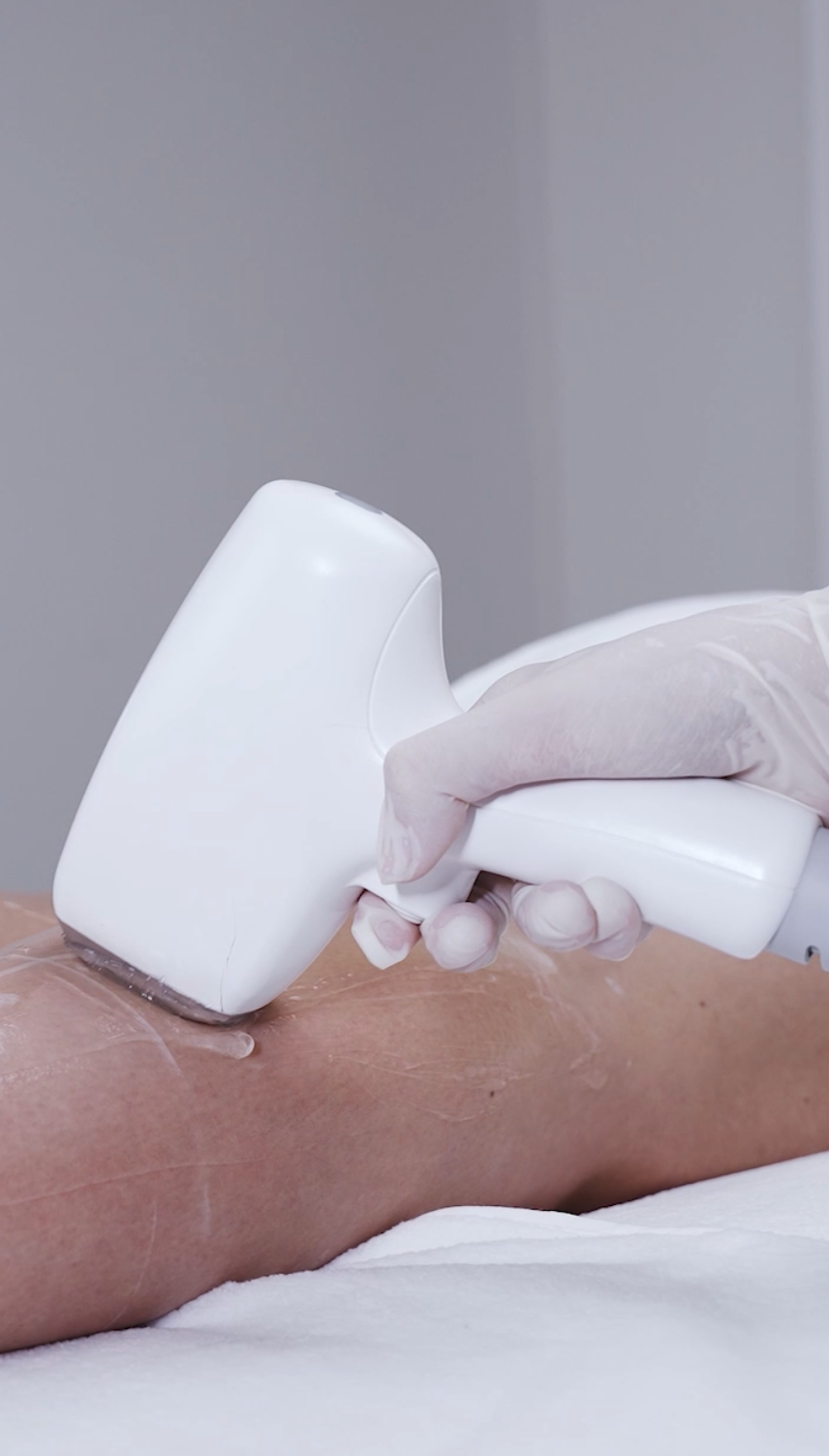 Medical grade diode laser hair removal treatment at CP Praxis Basel