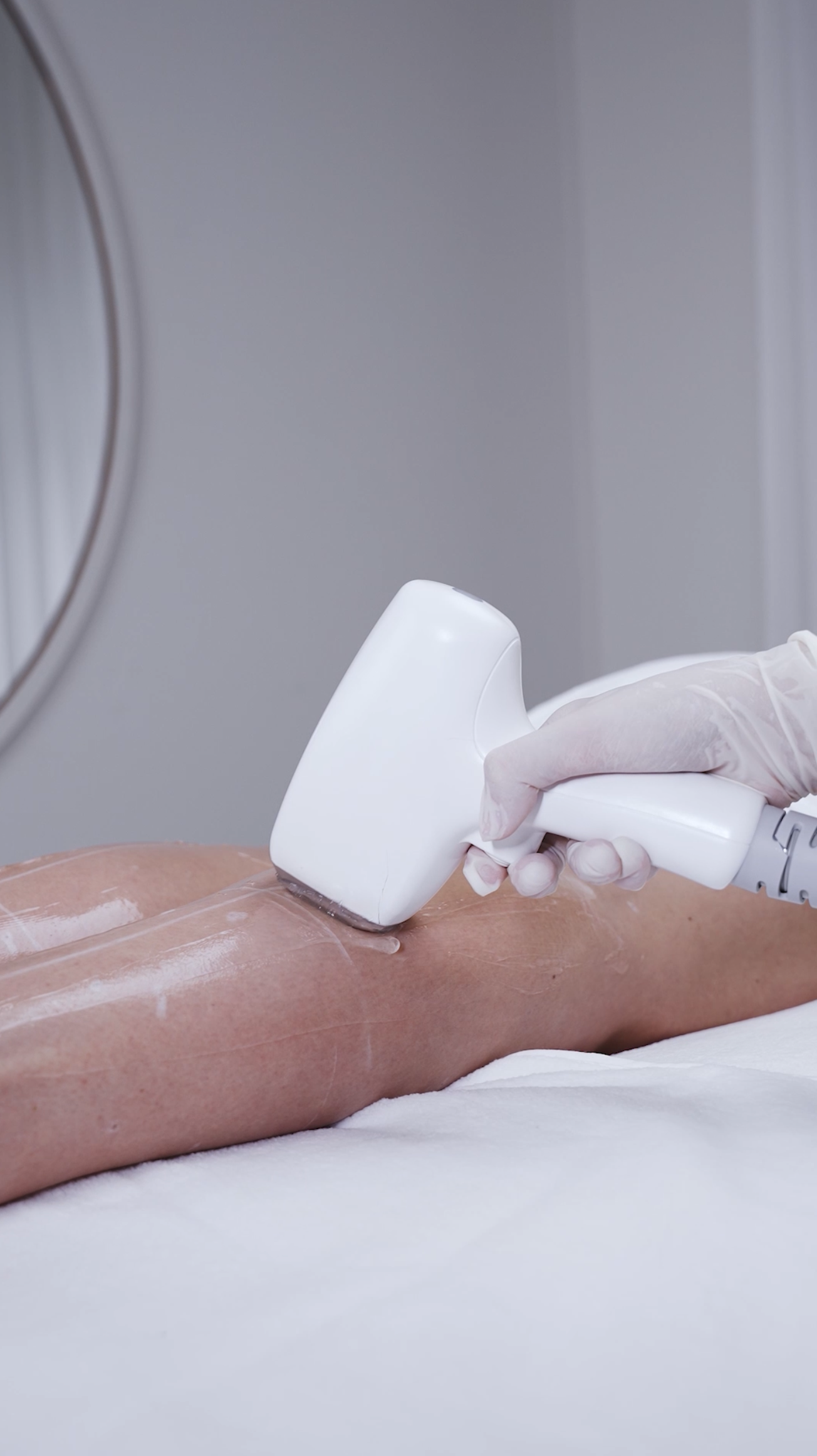 Medical grade diode laser hair removal treatment at CP Praxis Basel