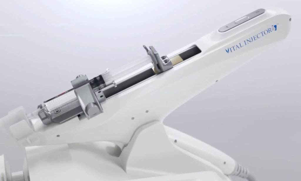 Mesotherapy with the MesoGun Vital Injector 2 at CP Praxis Basel