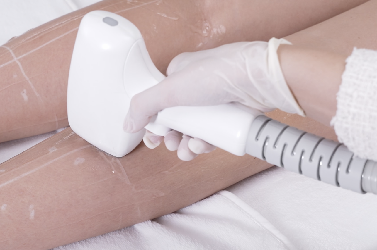 Professional laser hair removal treatment at CP Praxis Basel Switzerland