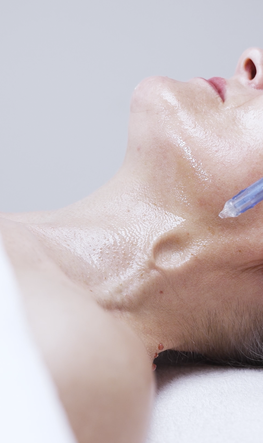 JetPeel treatment at CP Praxis in Basel