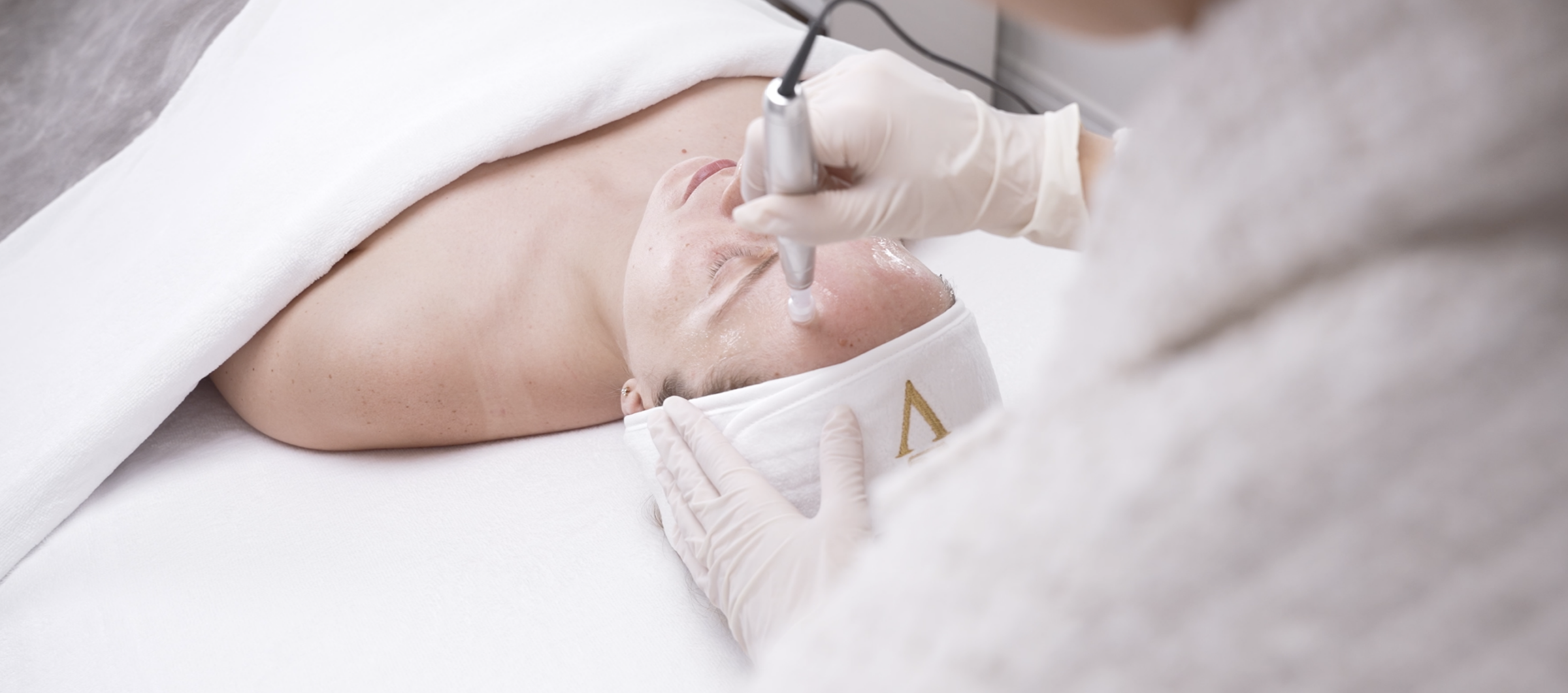 Microneedling treatment at CP Praxis Basel and Bottmingen
