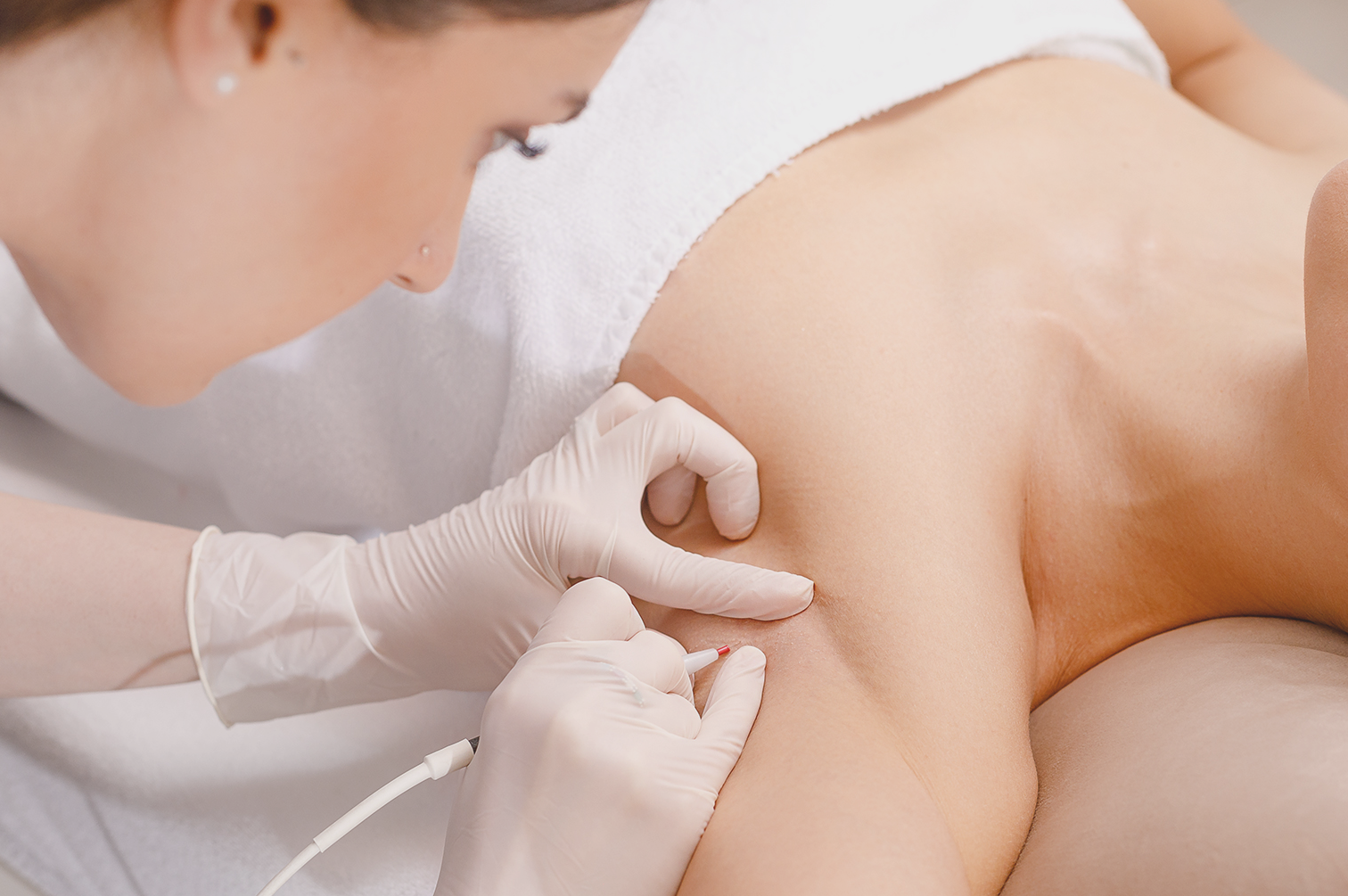 Professionelle Elektroepilation bei CP Praxis Basel und Bottmingen. EFZ-zertifizierte Spezialistin bei der Nadelepilation mit dem Apilus xCell System.