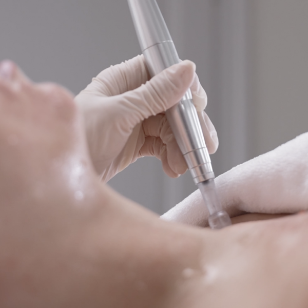 Microneedling treatment at CP Praxis Basel and Bottmingen