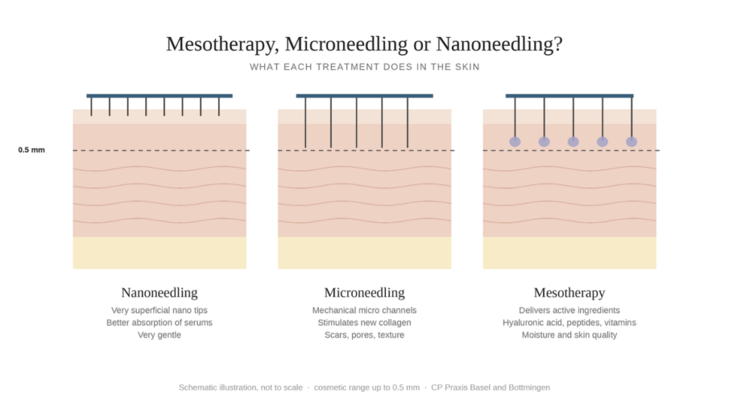 Vergleich von Nanoneedling, Microneedling und Mesotherapie in der Haut, alle im kosmetischen Bereich bis 0,5 mm