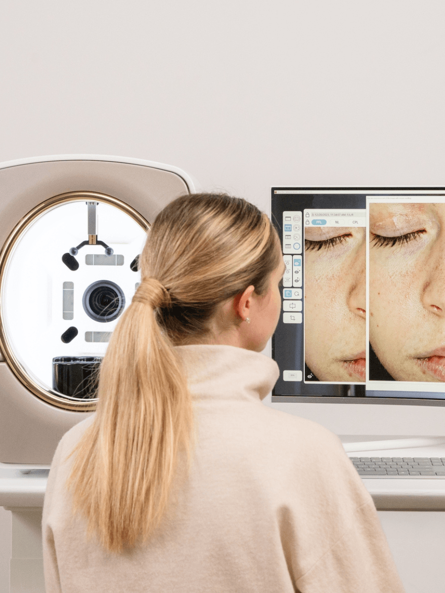 Skin Analysis Voucher