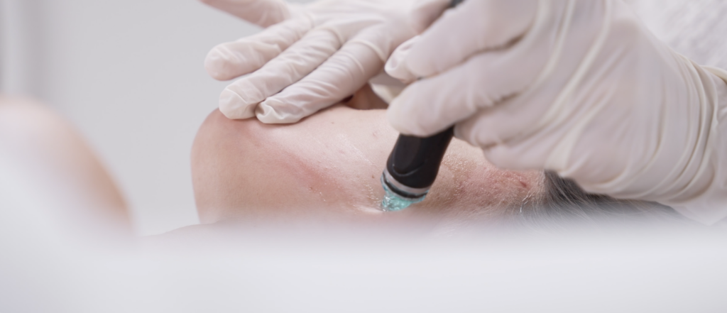 Hydrafacial treatment in Basel at CP Praxis using the original Hydrafacial® device for deep cleansing and skin hydration