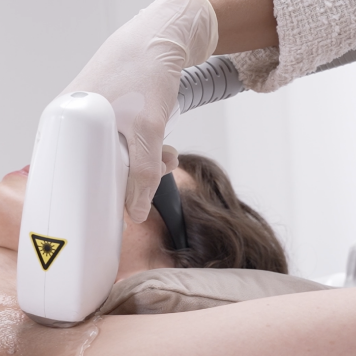 Laser Hair Removal Basel Medical Grade Diode Technology CP Praxis